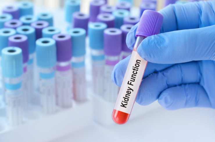 Renal Function Test